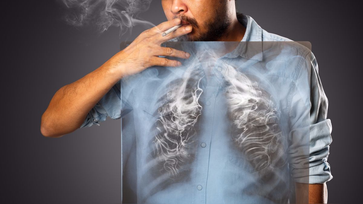 Enfermedades del sistema respiratorio tabaquismo